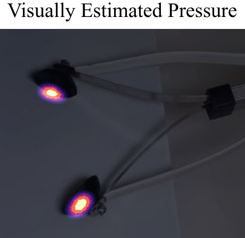 Visual pressure estimation teaser